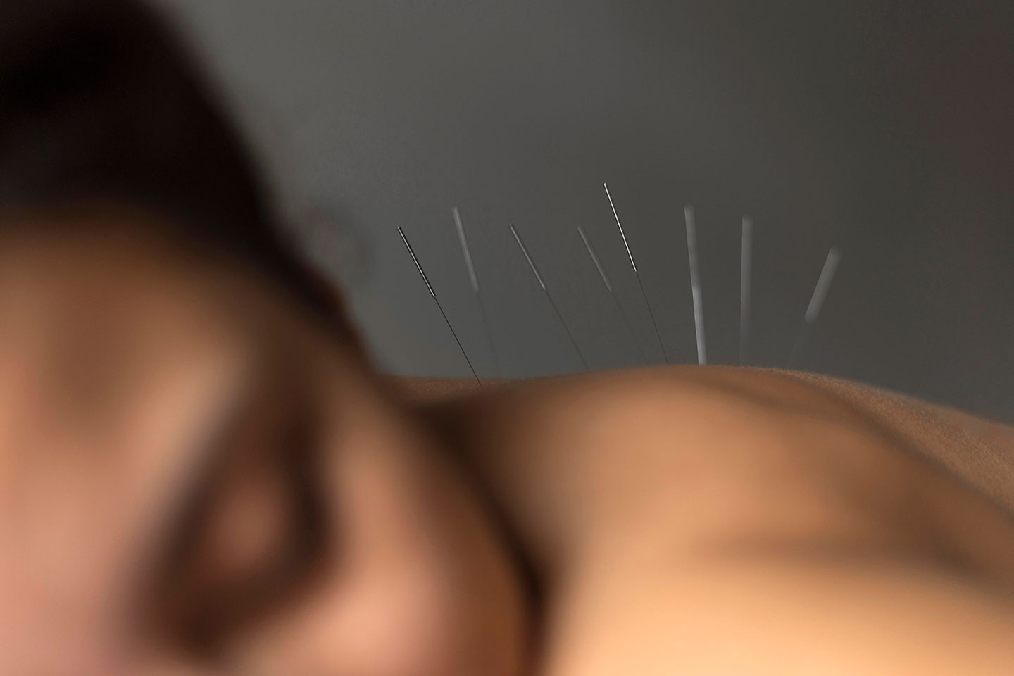 Massage och Akupunktur 60 minuter i Vasastan