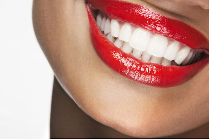 Tandblekning med Iconic Smile hos RV BeautyPlaza
