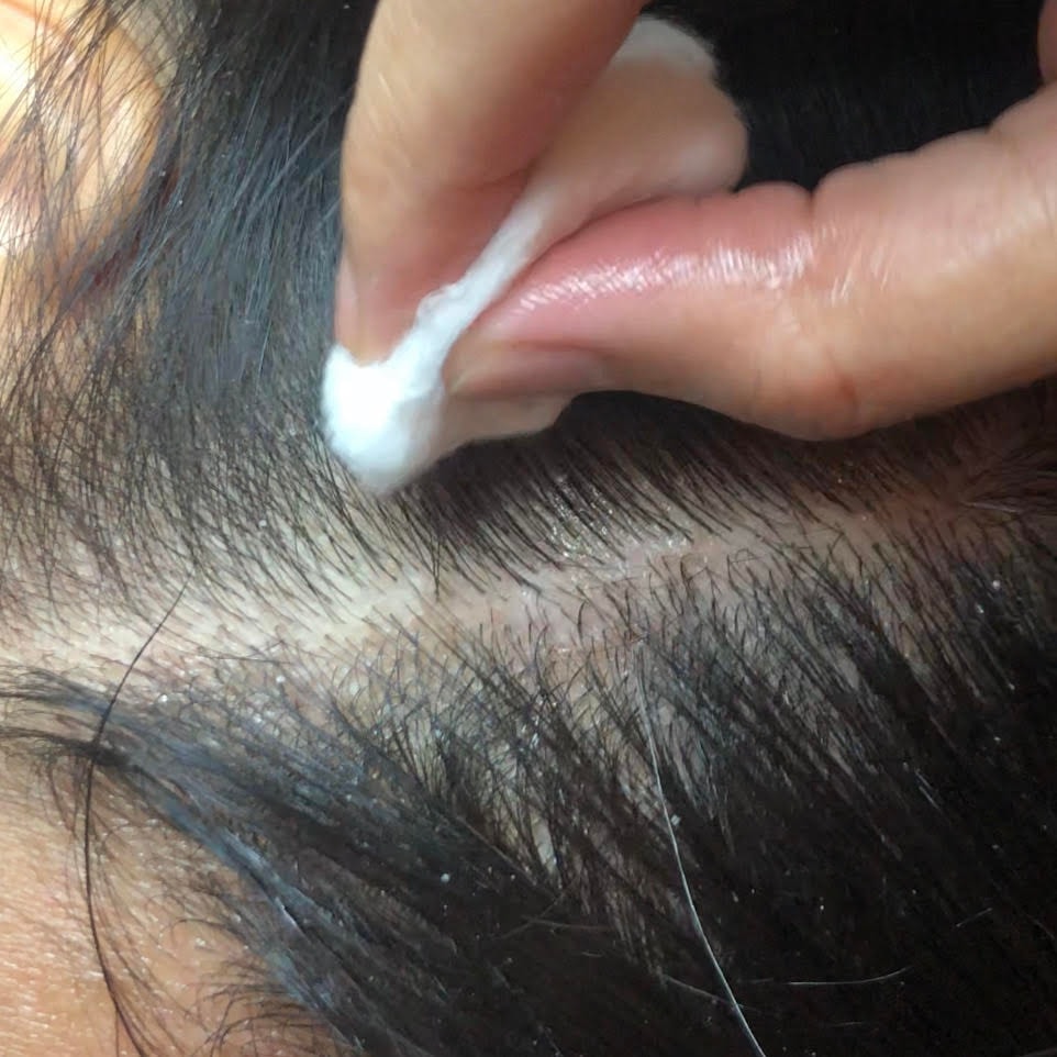 Avkopplande behandling av hårbotten hos Boracay Serene Sveavägen (2 av 3)