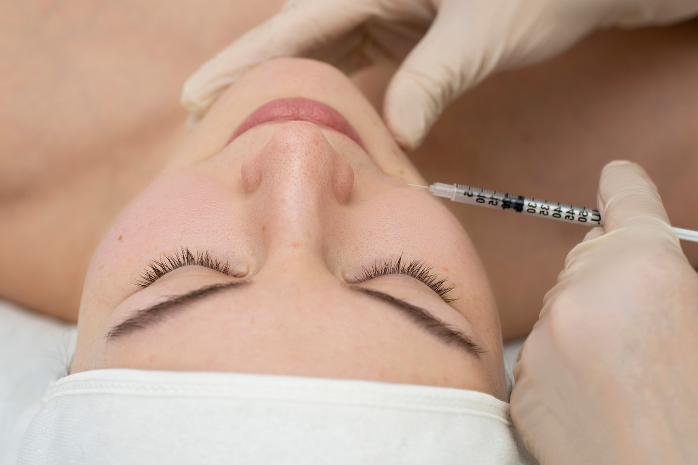 Botulinumtoxin för 1 till 3 områden hos Linné Tandläkarcenter