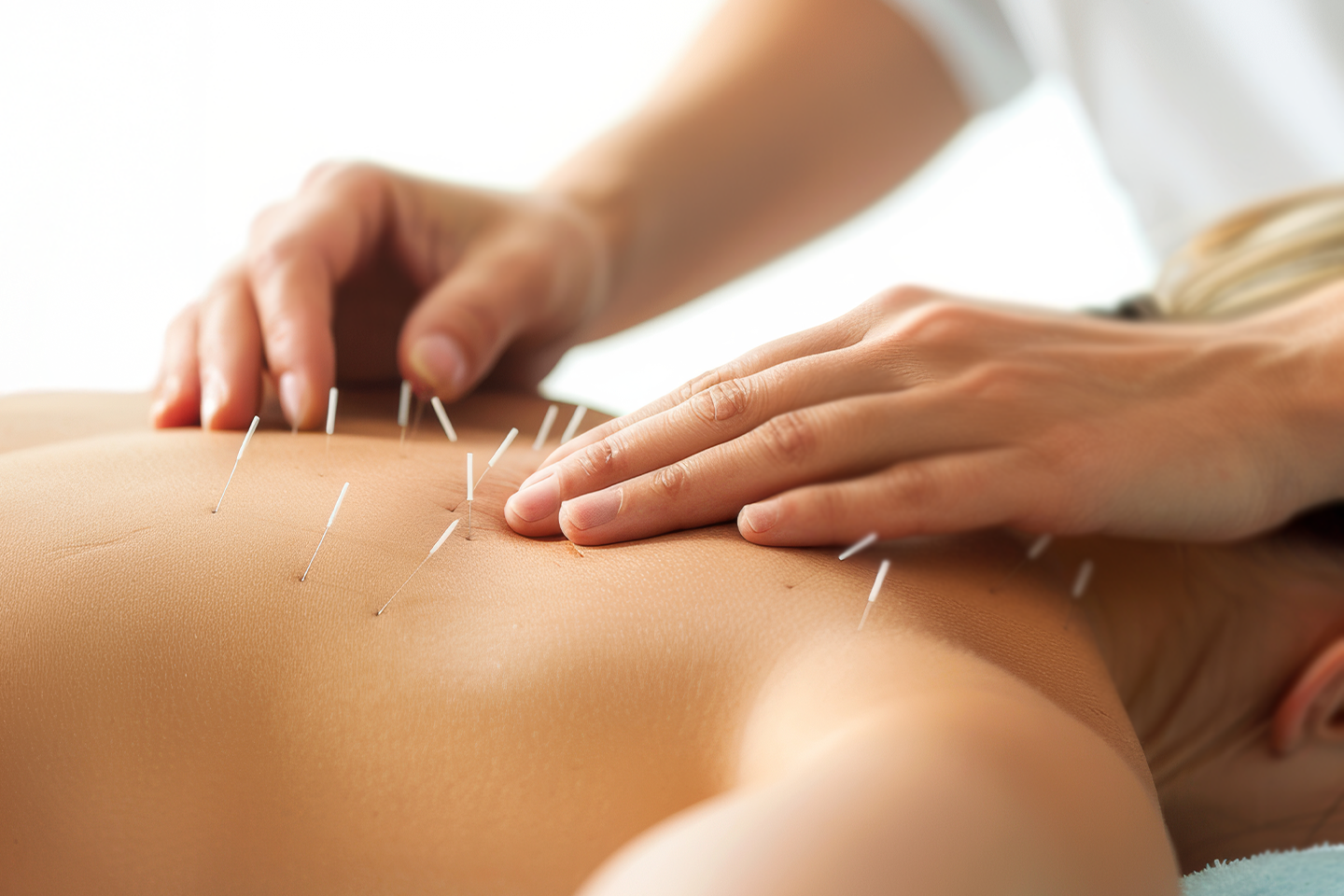 Akupunktur, akupressur, meditation och healing hos Norden KinaMedicin