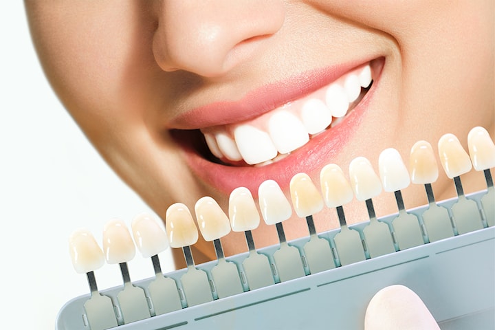 Profesjonell tannbleking, blek tennene dine opp til 7 nyanser lysere med ProDent Dual