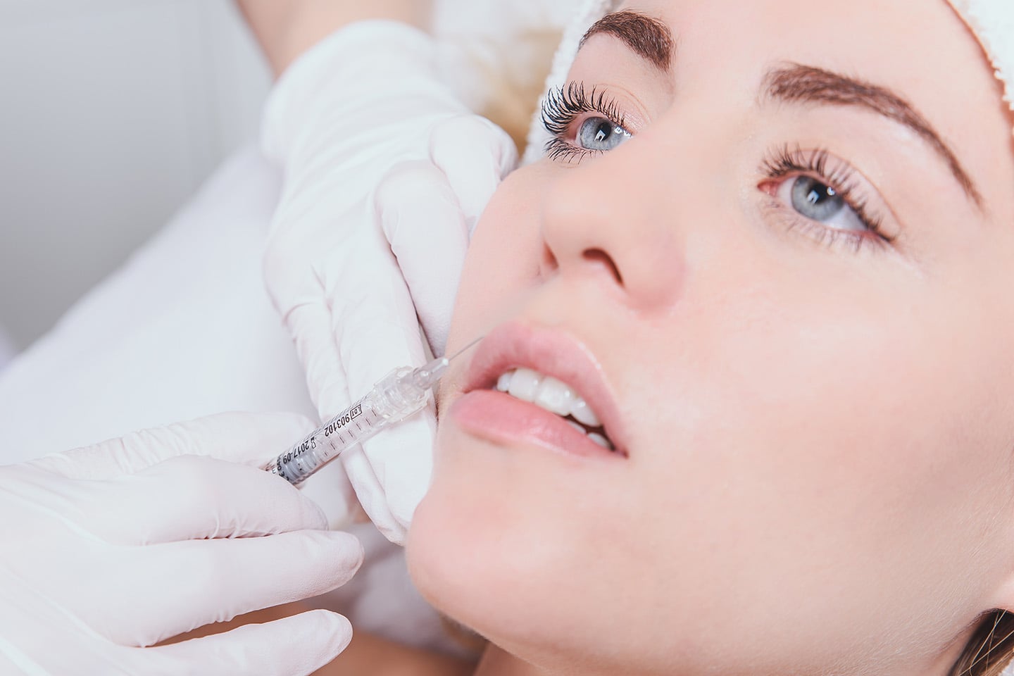 1,1 ml fillers och 3 områden botulinumtoxin hos Linné Tandläkarcenter