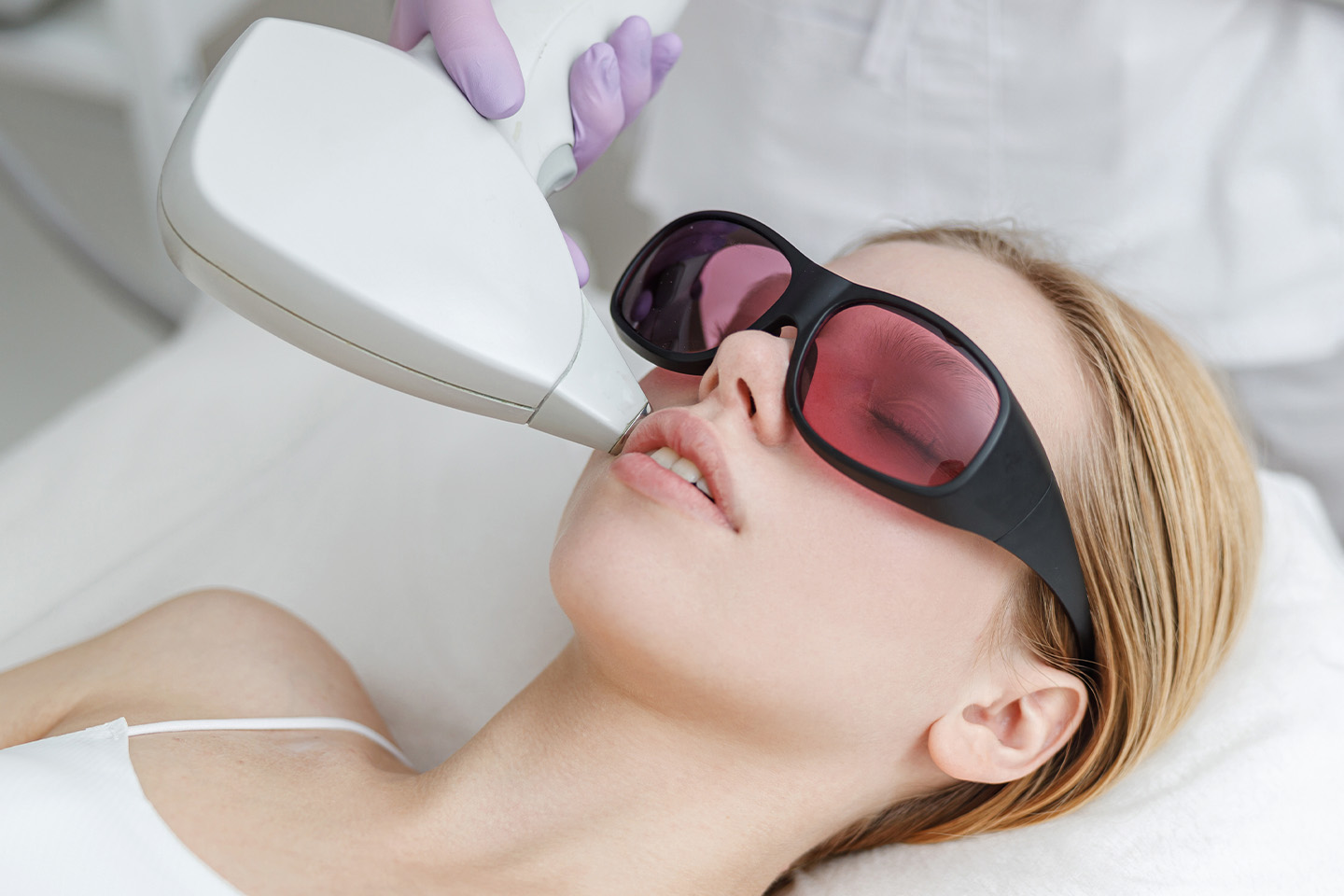 Hårborttagning med Soprano Titanium laser hos Sara Beauty Center, Linné