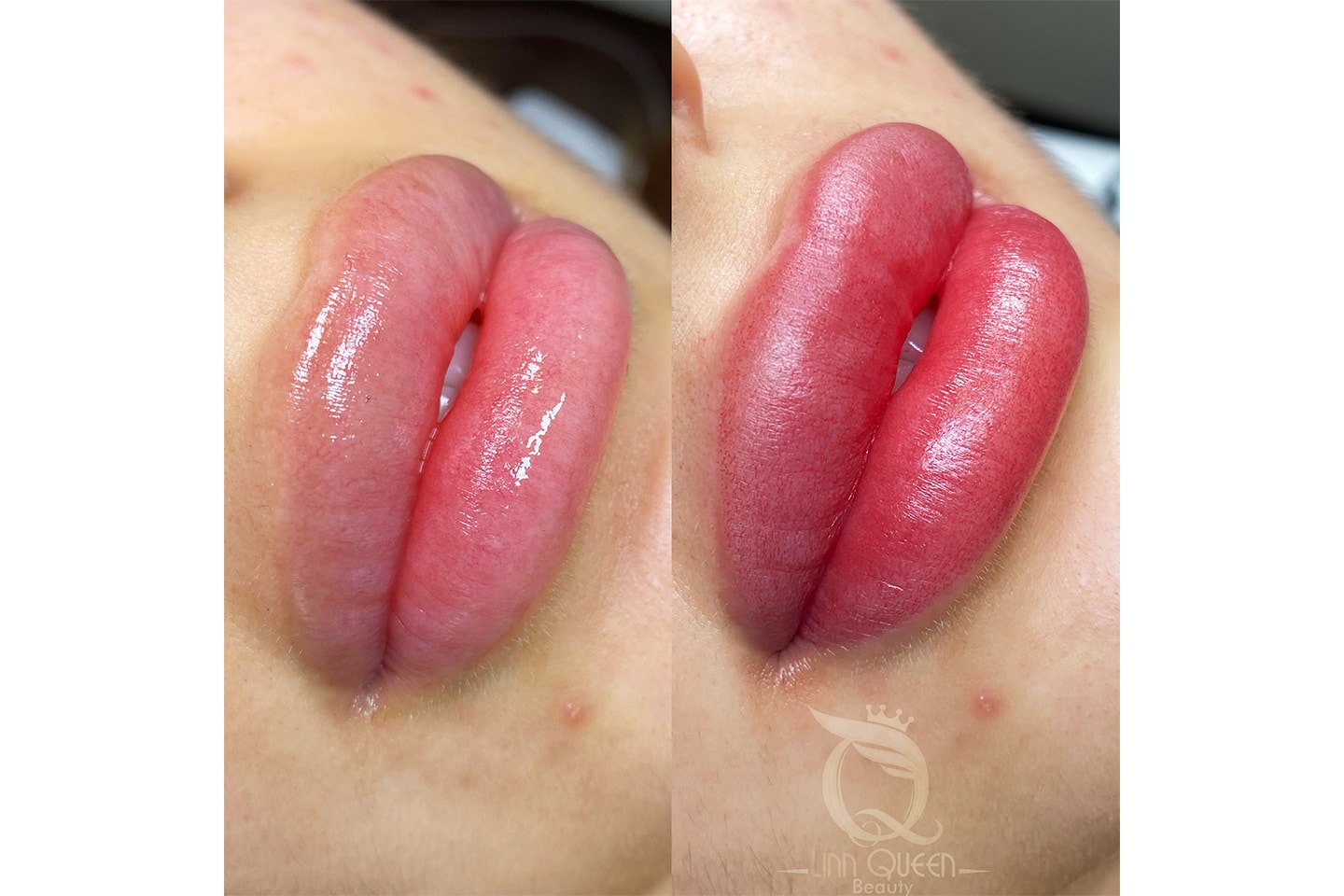 Nano lips läppigmentering hos Linn Queen Beauty (1 av 2)