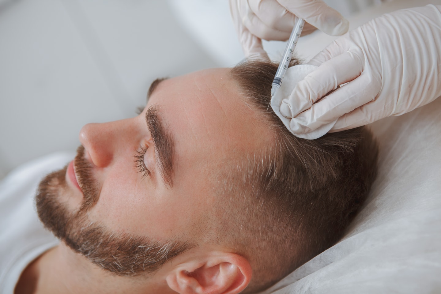 PRP-behandling för hår, ansikte eller dekolletage (1 av 2)