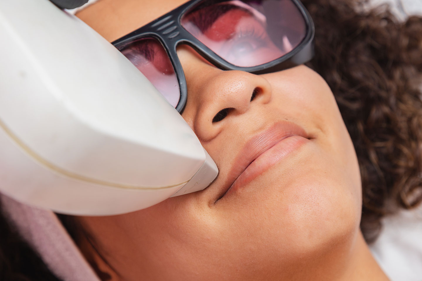 Permanent hårborttagning laser 4 tillfällen hos The Laser Boutique