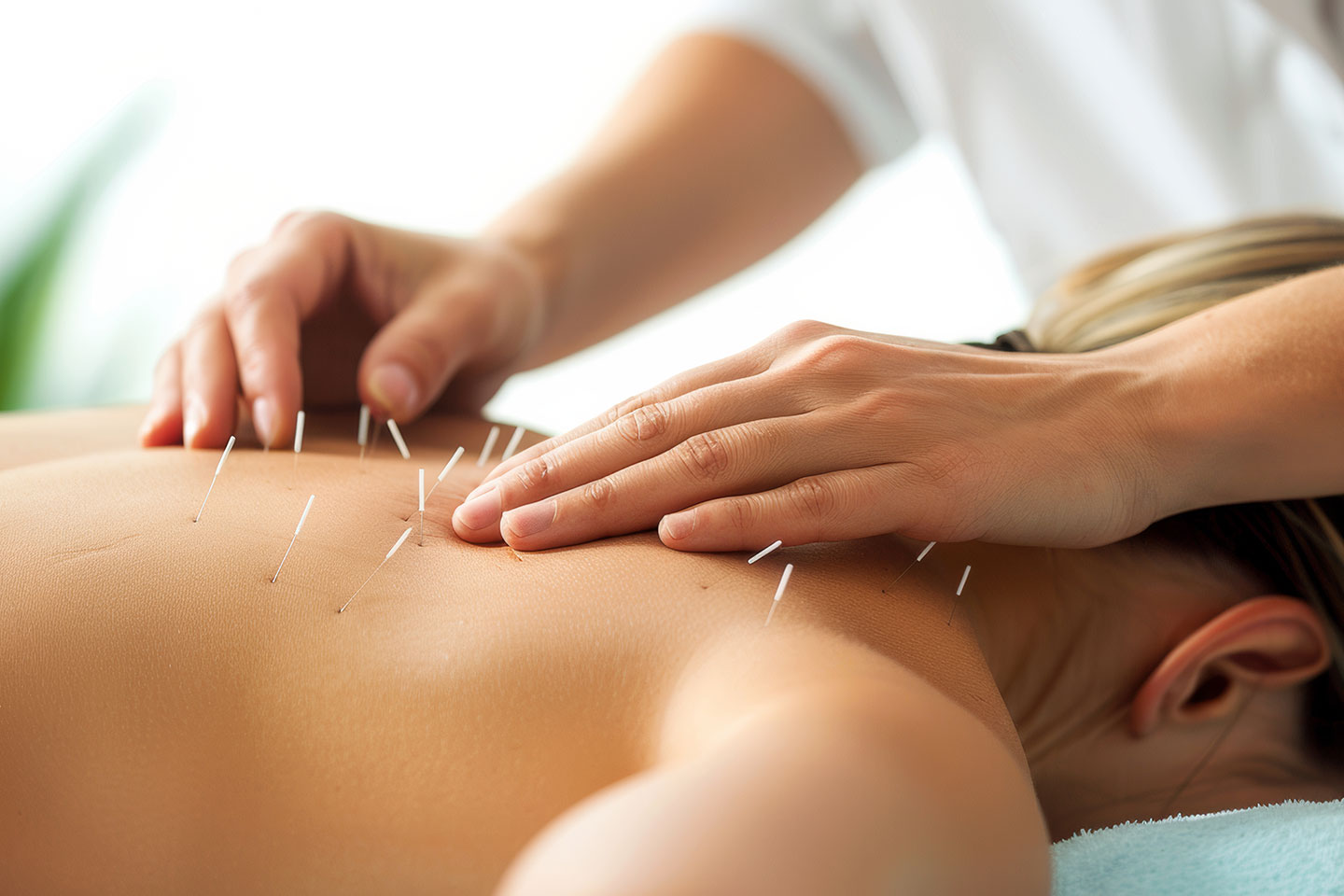 Massage och akupunktur 50 minuter i Kvillebäcken