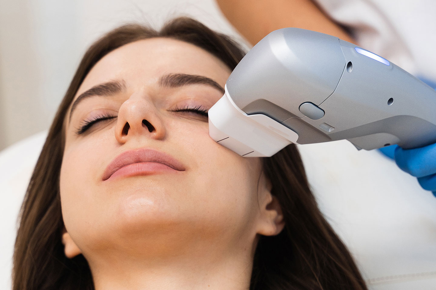 HIFU Ultra ansiktslyft och hudföryngring med V-max på Norrmalm
