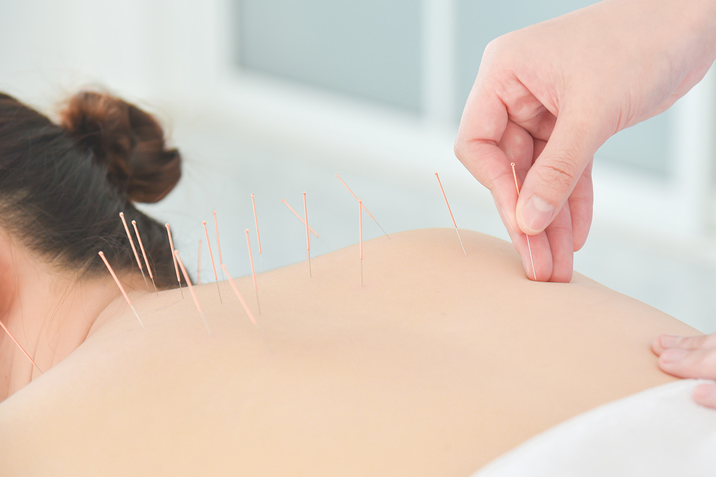 Massage & Akupunktur 60 min hos Kinesisk Hälsovård på Östermalm