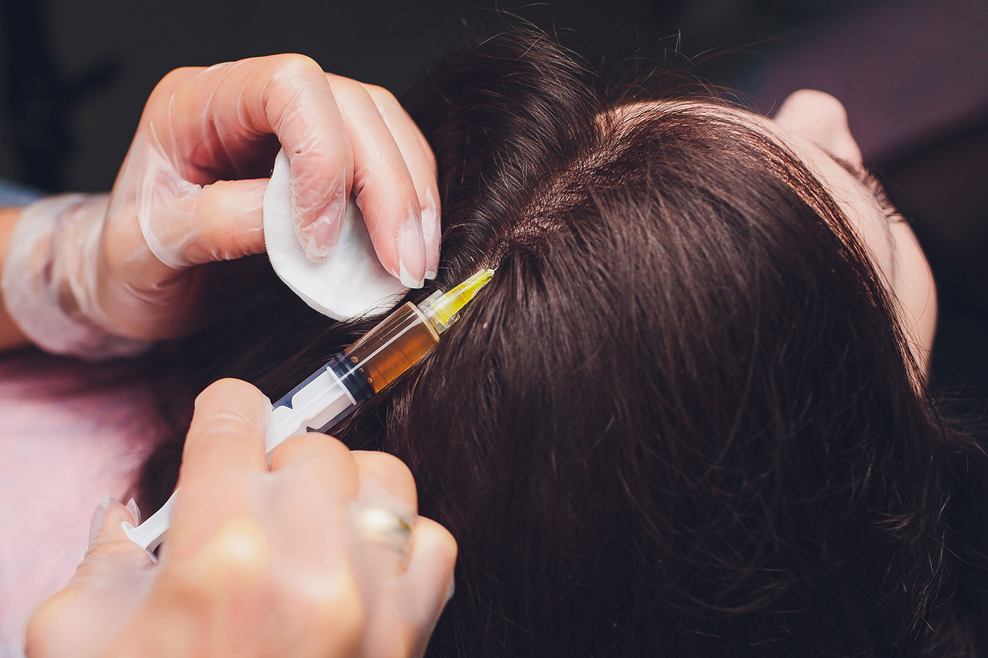 PRP-behandling 3 tillfällen för hår eller ansikte i Västra hamnen