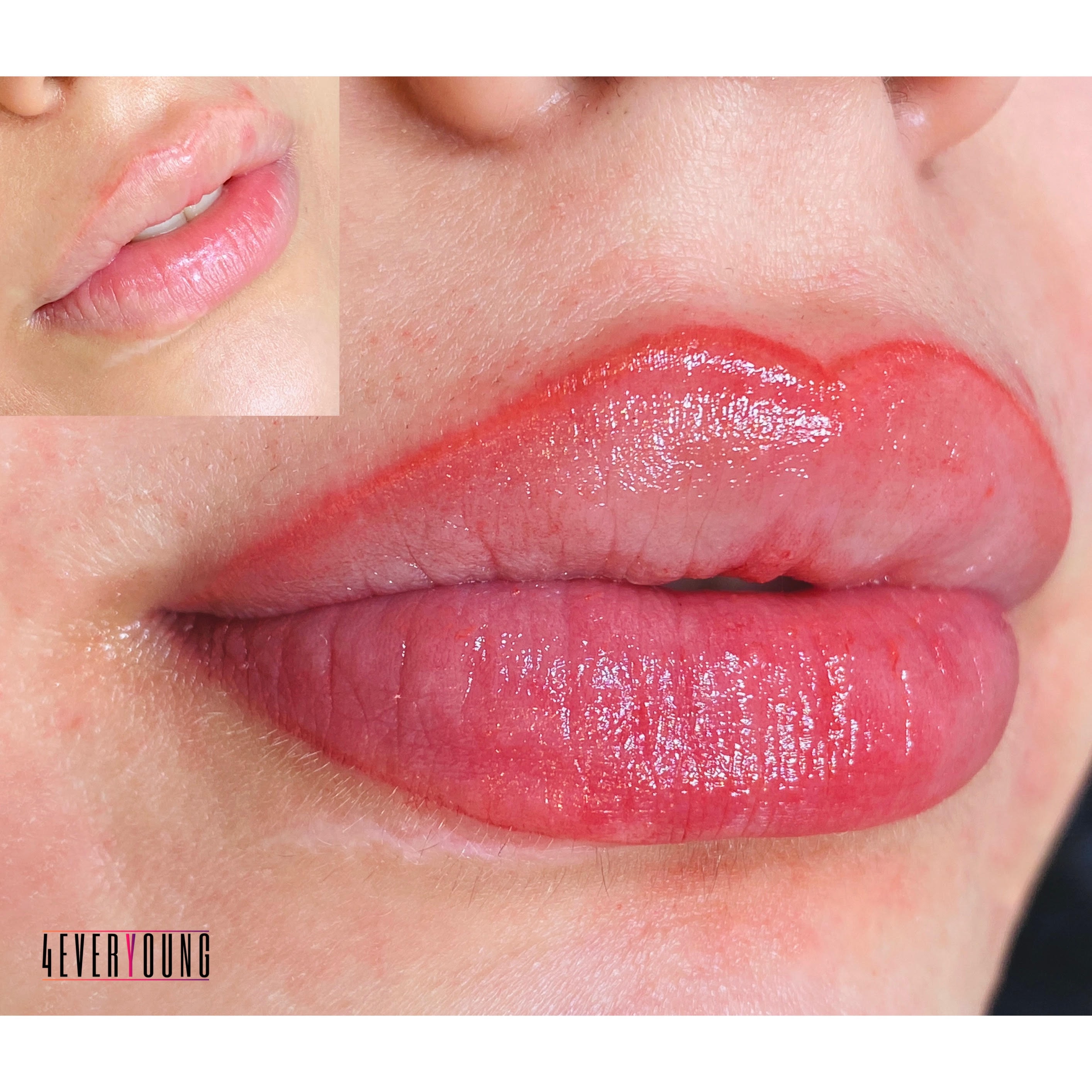 Nano lips läppigmentering hos 4ever Young Beauty (3 av 5)