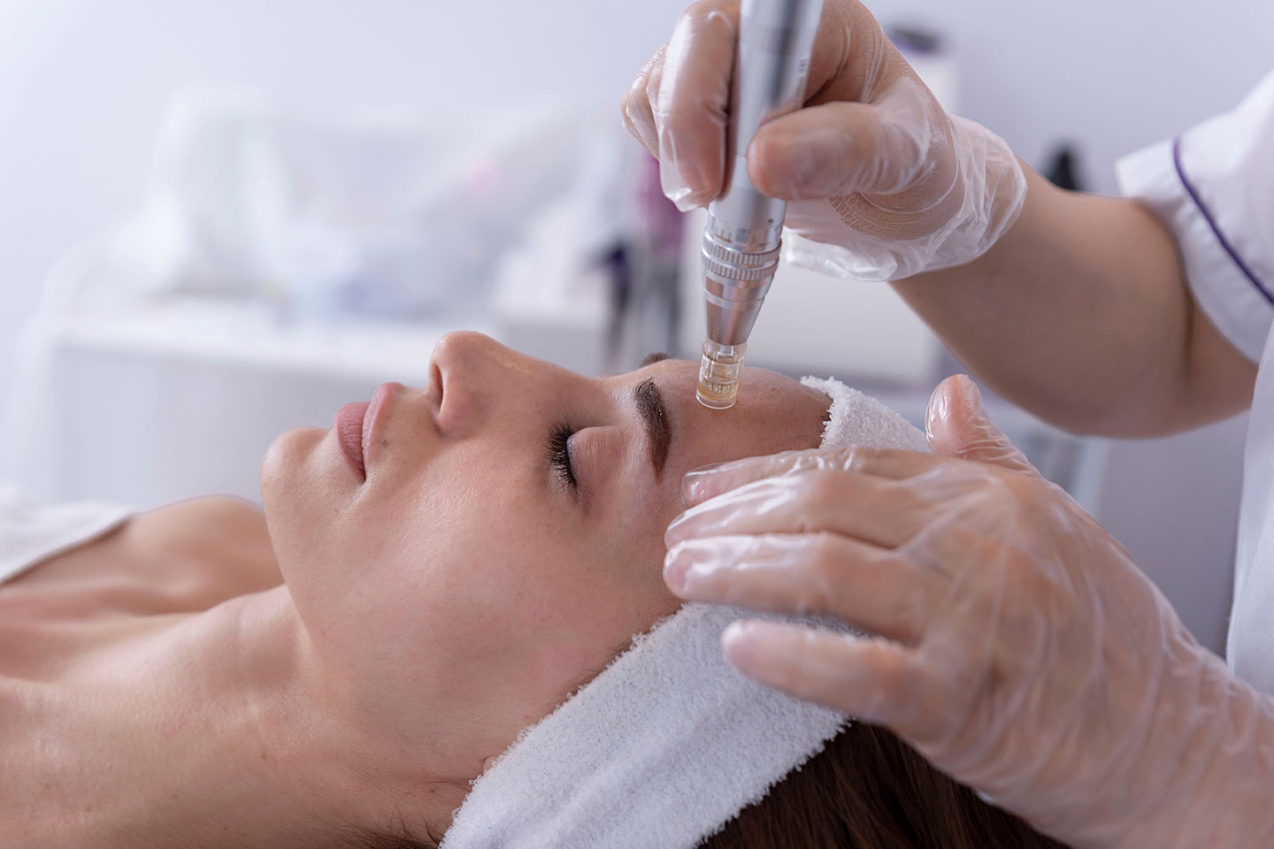 Microneedling med vitamincocktail 1-2 behandlingstillfällen i Vasastan
