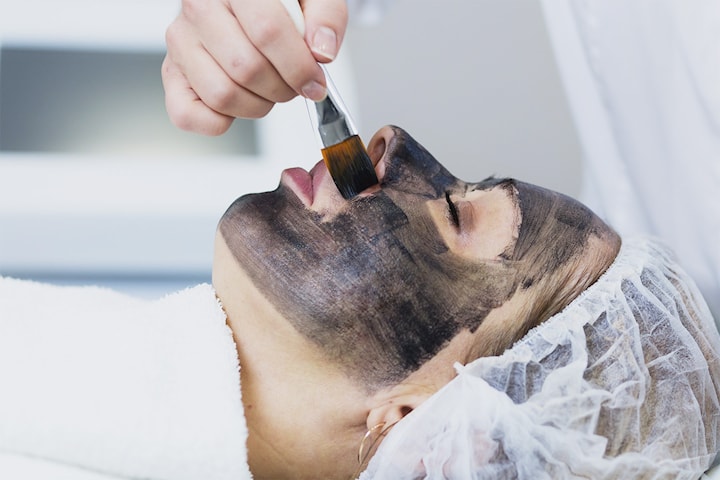 Ansiktsbehandling, Carbon Peeling med laser