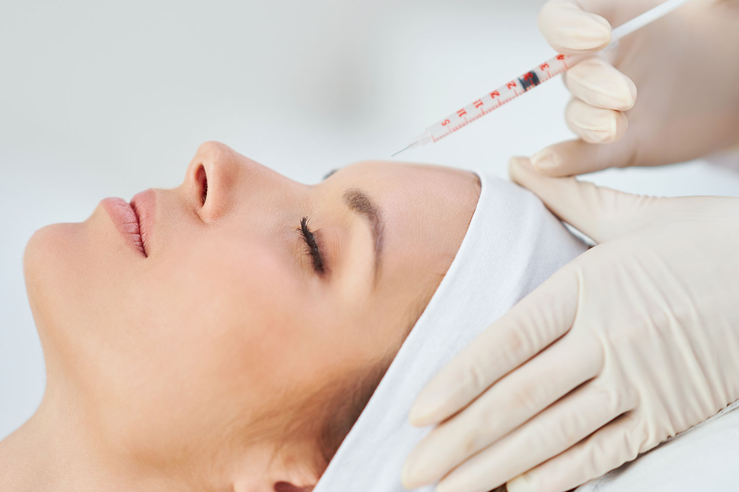 Botulinumtoxin: reducering av rynkor på 3 områden i Kortedala