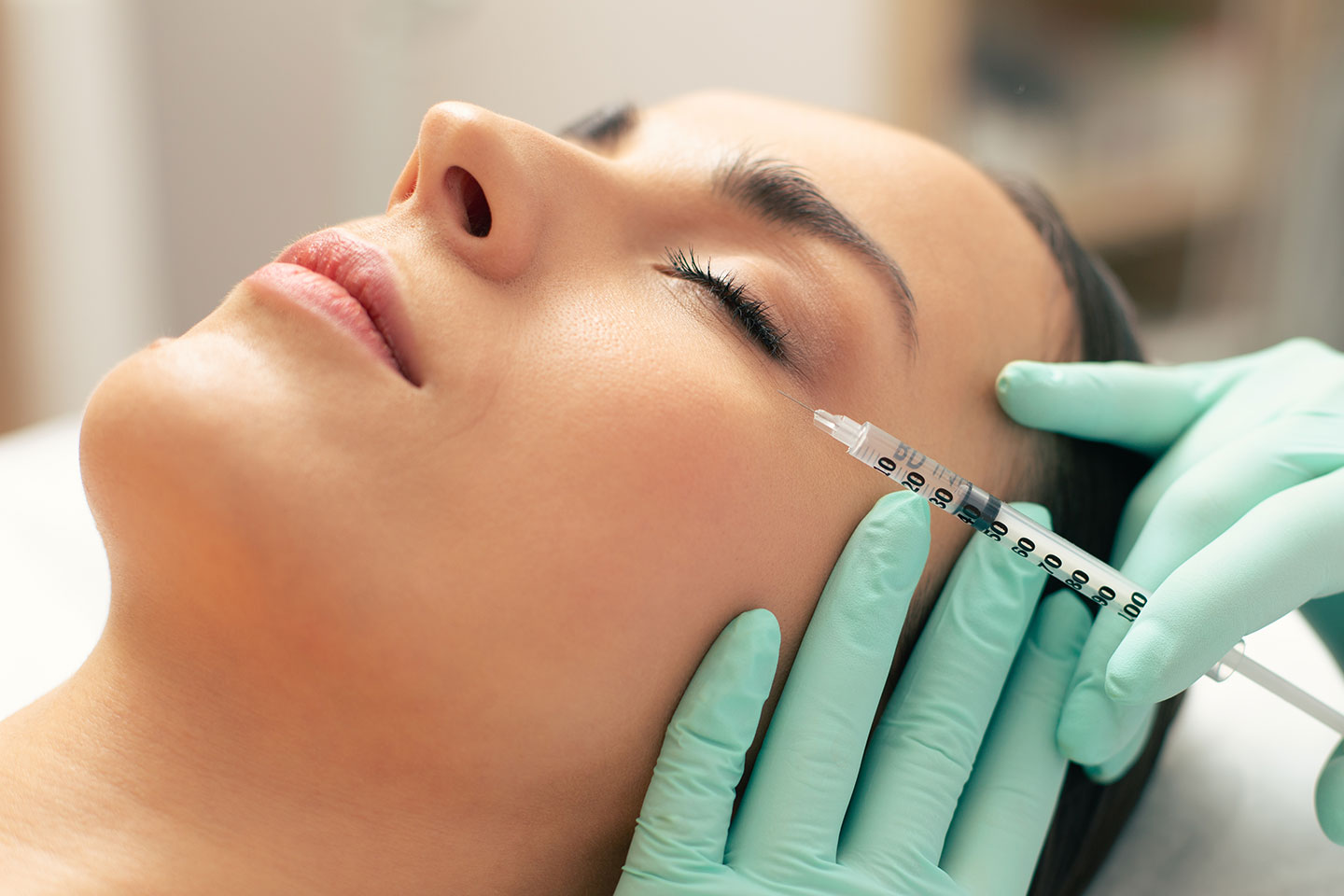 Injektion med botulinumtoxin 1-3 områden hos Fiore Clinic vid Avenyn