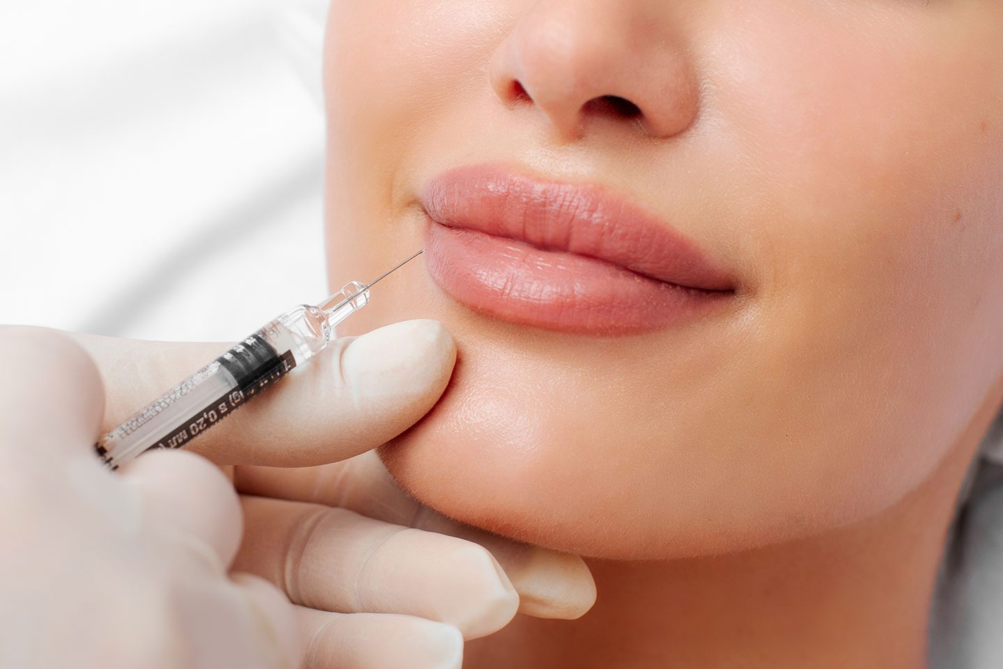 Fillers 1,1 el. 2,2 ml med Revolax hos EllieGant Salong vid Vasastaden