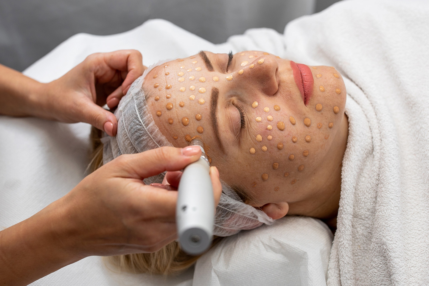 BB-Glow hos Göteborg Queen Beauty Klinik i Vasa