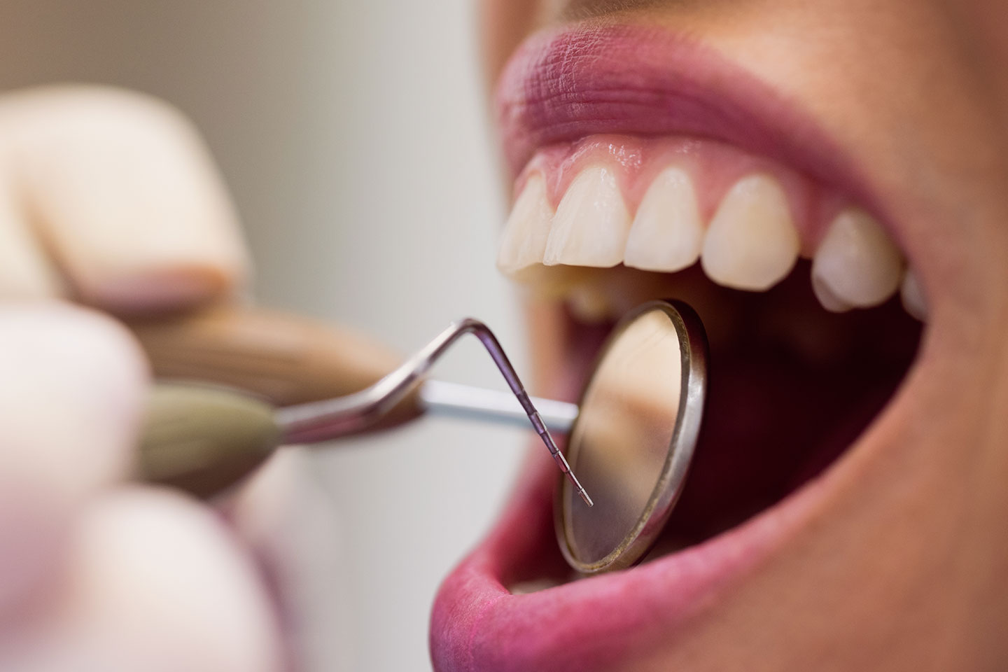 Tandundersökning med Airflow & presentkort på 500 kr i Sundbyberg