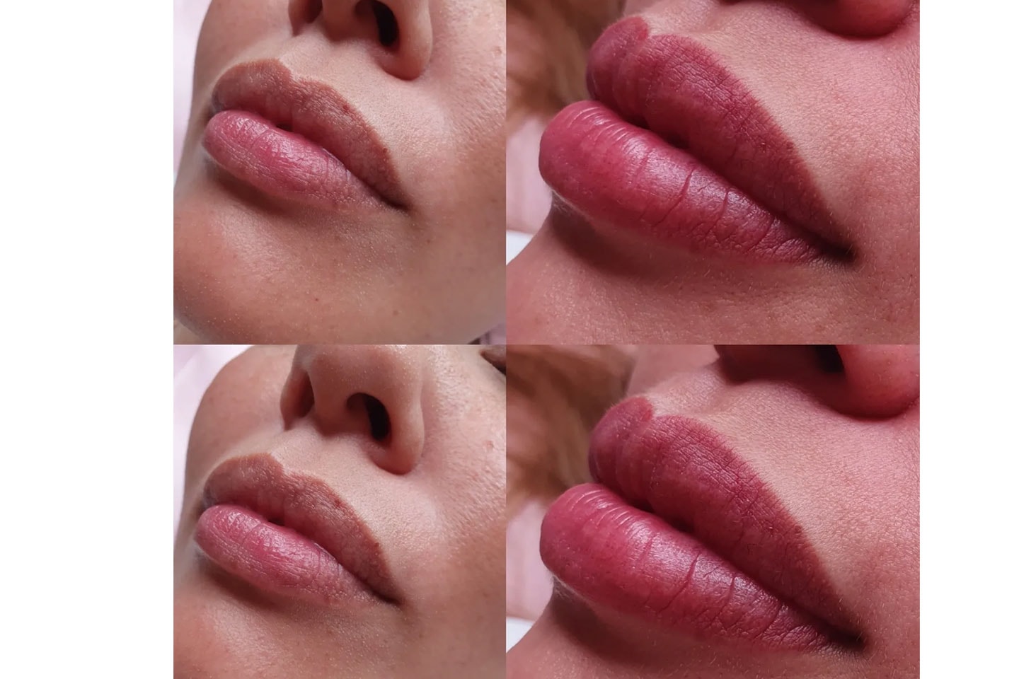 Kosmetisk läpptatuering- Lip blush (4 av 6) (5 av 6)
