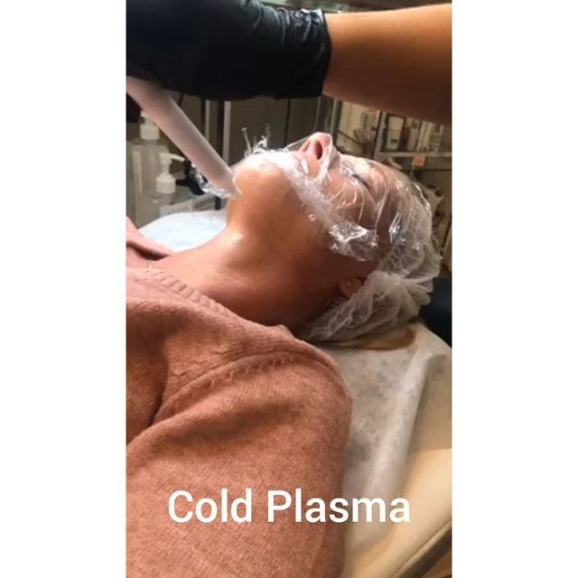 Cold plasma - för hela ansiktet (2 av 4)