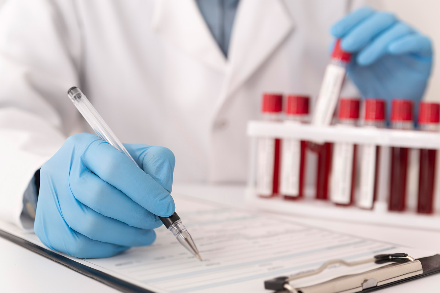 Rabattkod: Hälsotest via blodprov och läkaranalys hos Testum