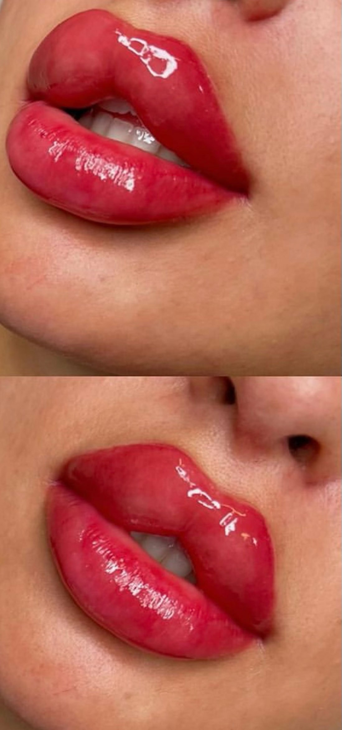 Kosmetisk tatuering av läppar med återbesök hos FlawlessFace Klinik (1 av 2)