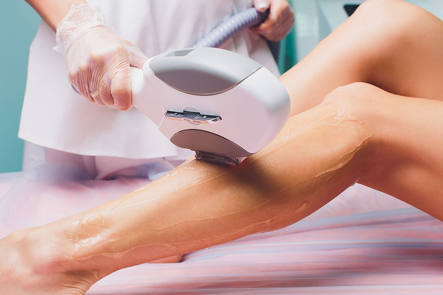 Permanent hårborttagning med laser i Vasastan
