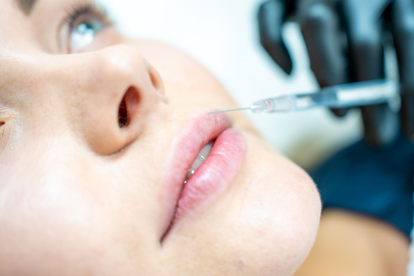 Fillers 1-2 ml på valfria områden hos Luxe Clinic 44 vid Ullevi