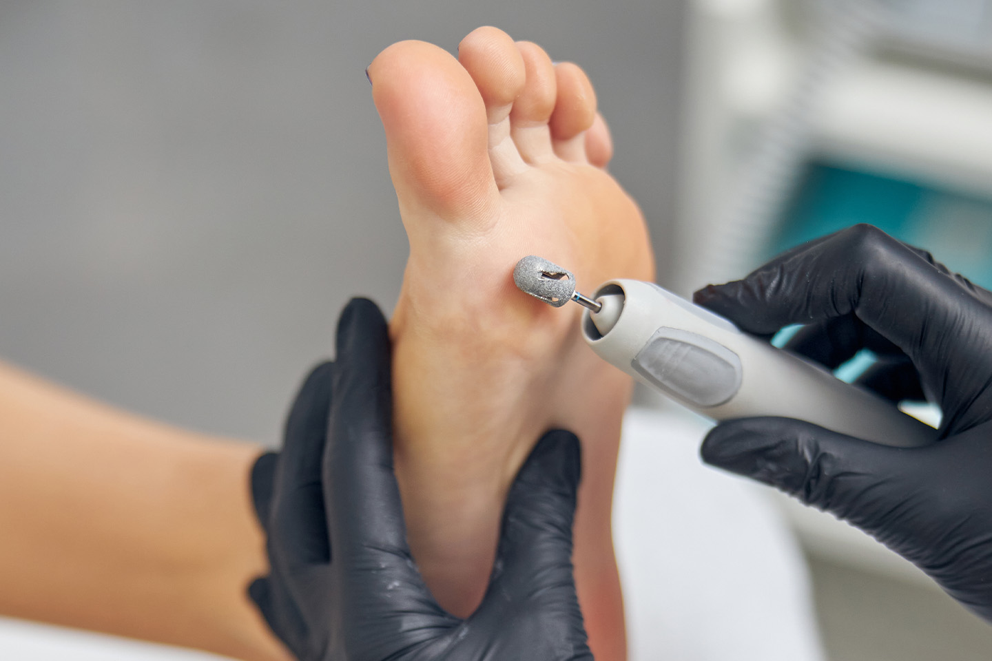 Medicinsk fotvård 50 min hos Unikvård i Vasastan