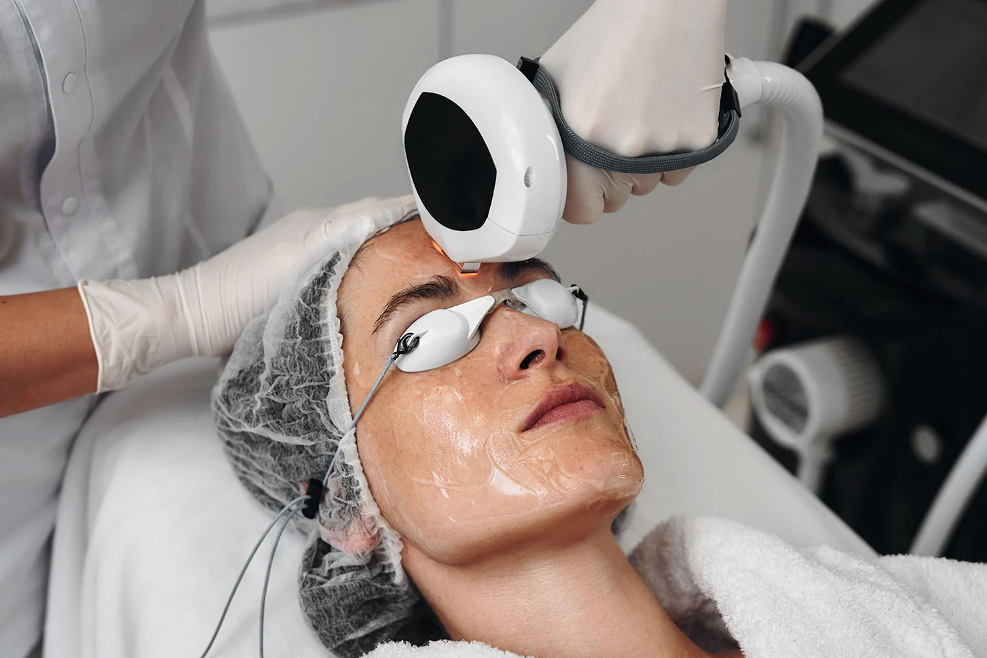 IPL-behandling 3 tillfällen hos Blanka Kliniken på Östermalm