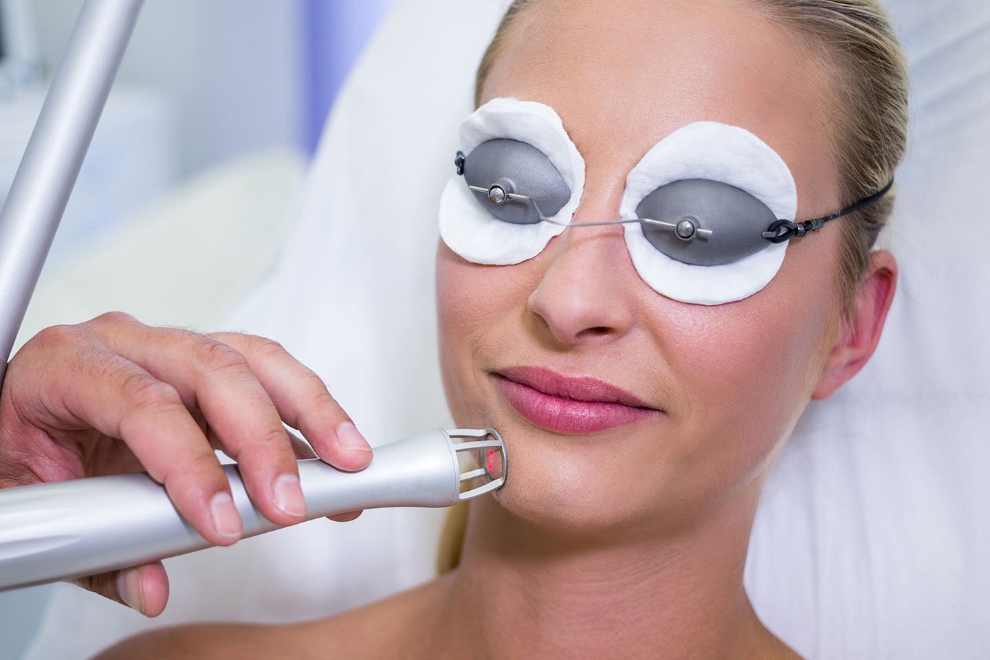 Hudföryngring med Fractionerad Co2-laser vid Korsvägen