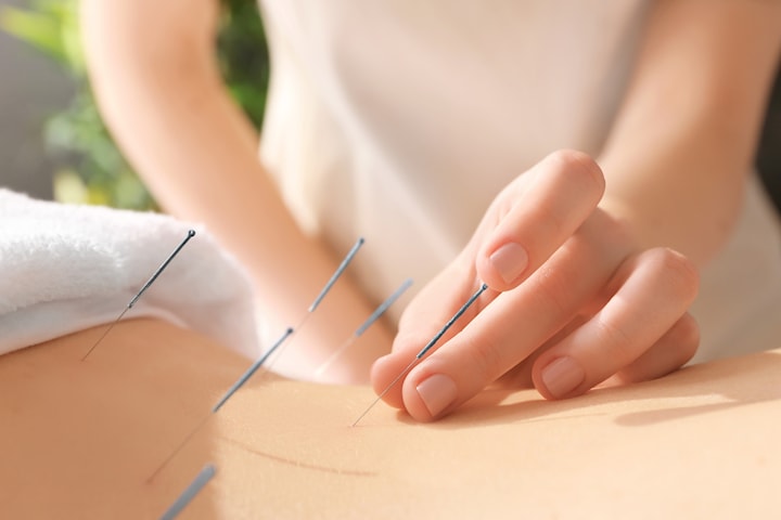 Akupunktur, massage eller ljusterapi